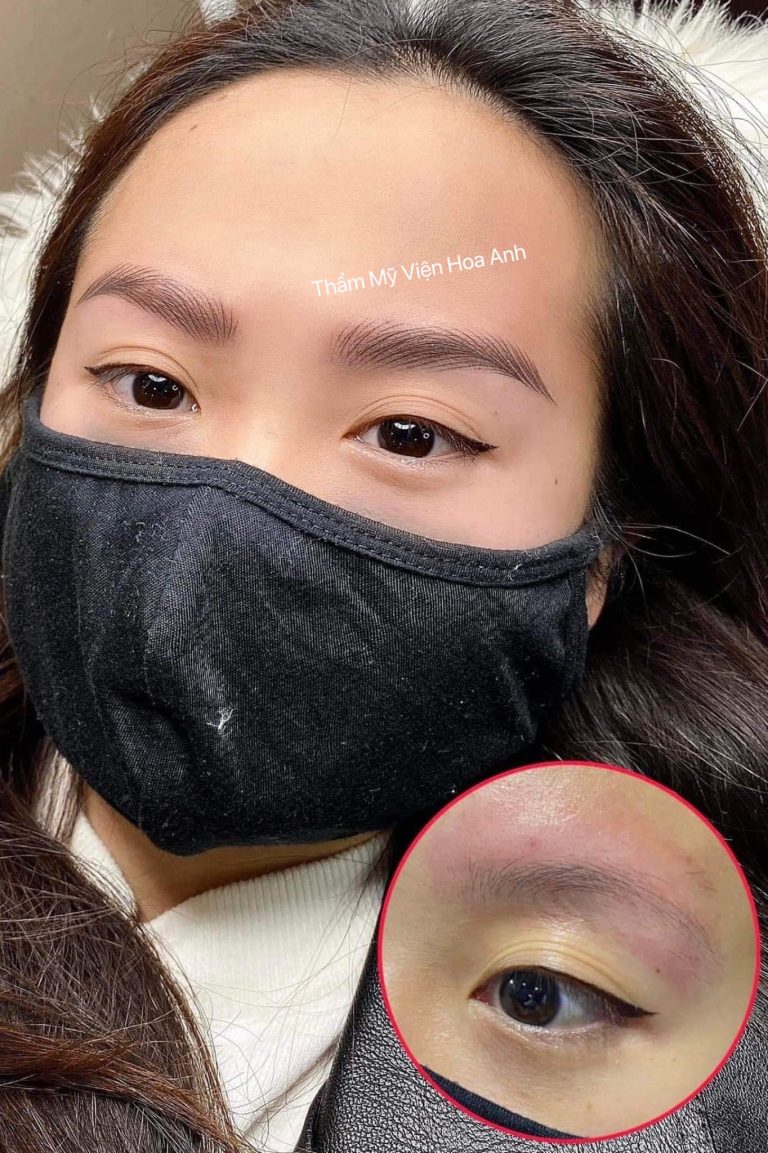Before - After phun thêu chân mày